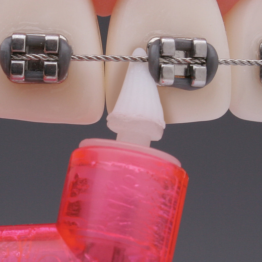 2pro Total Access Tip used around an orthodontic bracket