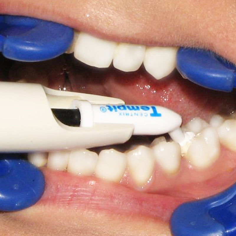 Tempit prefilled tip in use